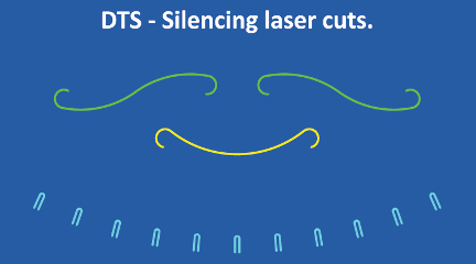 DTS - Silencing laser cuts picture